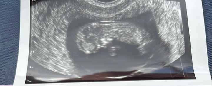 Nub theory. Maschio o femmina?💙🎀 - 1