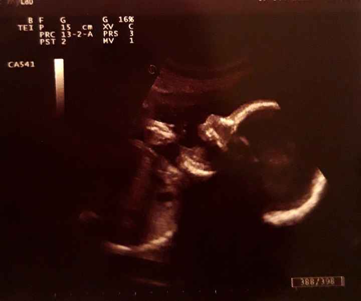 Mamme di Gennaio 2020 ❤️ - 1