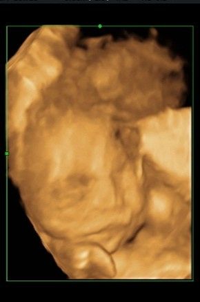 Future mamme ottobre 2020 1
