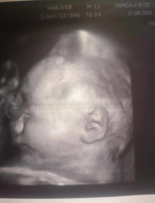 Future mamme ottobre 2020 - 1