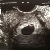 1a eco bellissima 😍 - 2