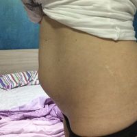 13esima settimana - 2