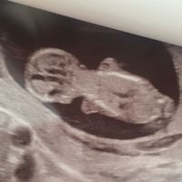 Eco translucenza... perfetta 😍😇 - 2