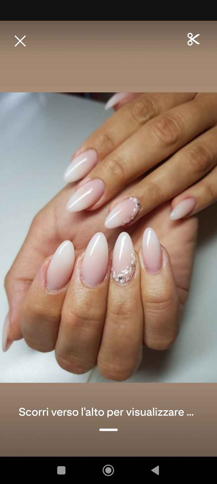 Lunedì andrò a fare la ricostruzione alle mani - 2