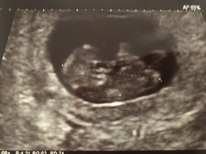 Future mamme novembre 2020 🌞🍁🌷♾ - 1