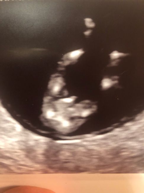 Future mamme novembre 2020 🌞🍁🌷♾ - 1