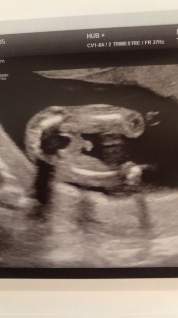 Future mamme novembre 2020 🌞🍁🌷♾ - 1