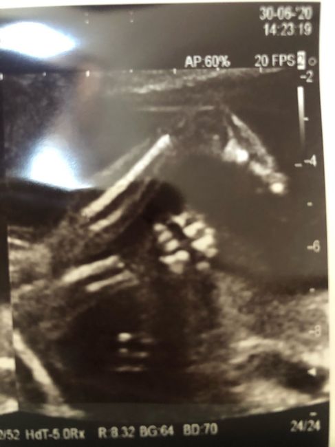 Future mamme novembre 2020 🌞🍁🌷♾ - 2