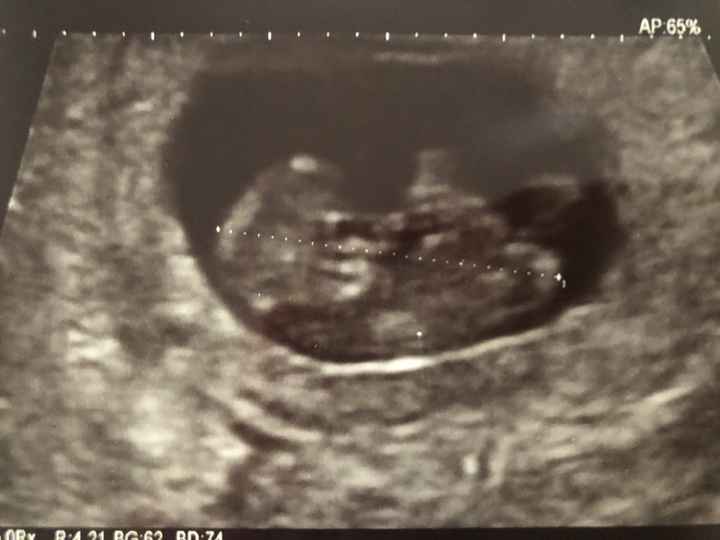 Future mamme novembre 2020 🌞🍁🌷♾ - 1