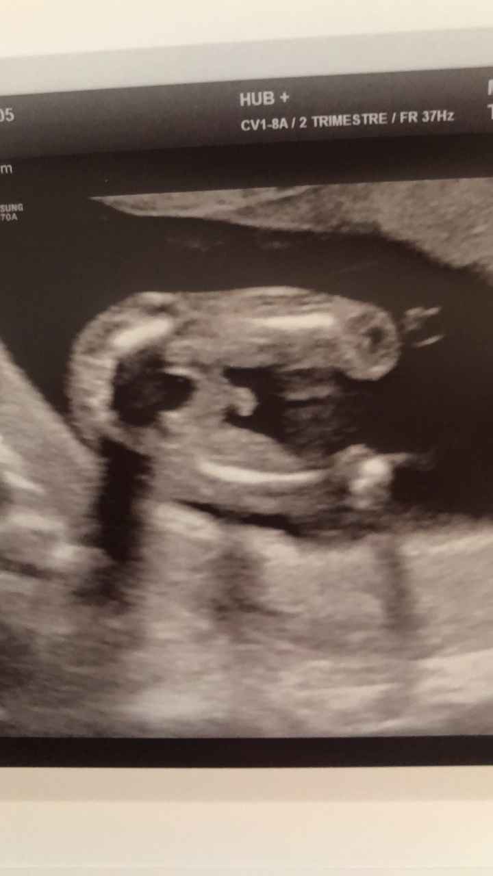 Future mamme novembre 2020 🌞🍁🌷♾ - 1