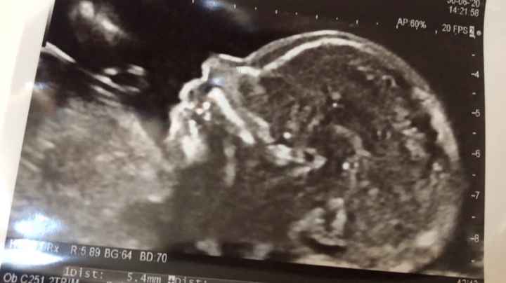 Future mamme novembre 2020 🌞🍁🌷♾ - 1