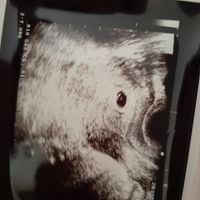 Metodo Ramzi! Chi ci sa azzeccare? - 1