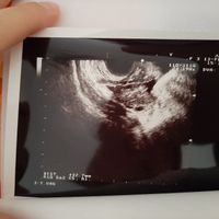 Metodo Ramzi! Chi ci sa azzeccare? - 2