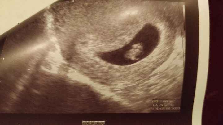 Mamme di Agosto 2020😍🤞😍 - 1