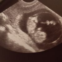 Mamme di Agosto 2020😍🤞😍 - 1