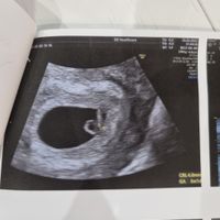 Metodo Ramzi 😂😉❤️ - 2