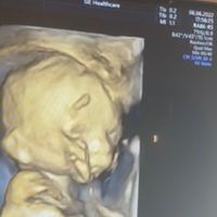 Future mamma novembre 2022 🍇🍁🧸 - 1