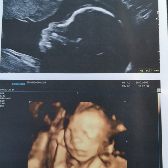 Future mamme Luglio 2021... - 1