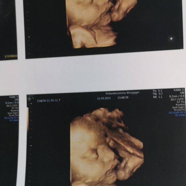 Future mamme Luglio 2021... - 1