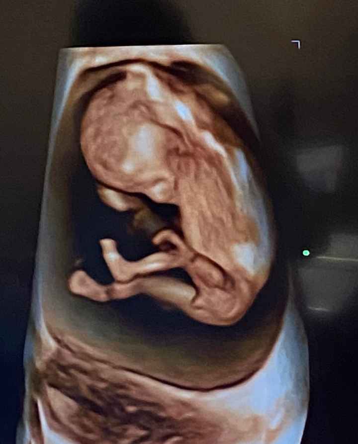 Future mamme ottobre 2022 - 1