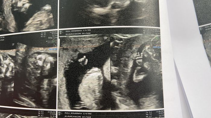 Future mamme di febbraio 2022 1