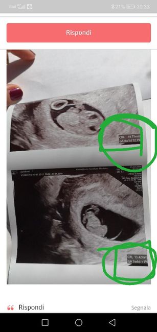 Maschio o femmina??? 👦🏻 o 👧🏻 3