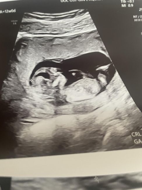 Nub theory, giochiamo un po’ 1