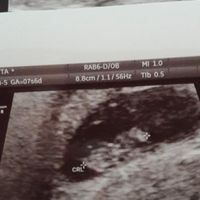 Metodo Ramzi... sfatiamo il mito? 💙 o 💖 - 1