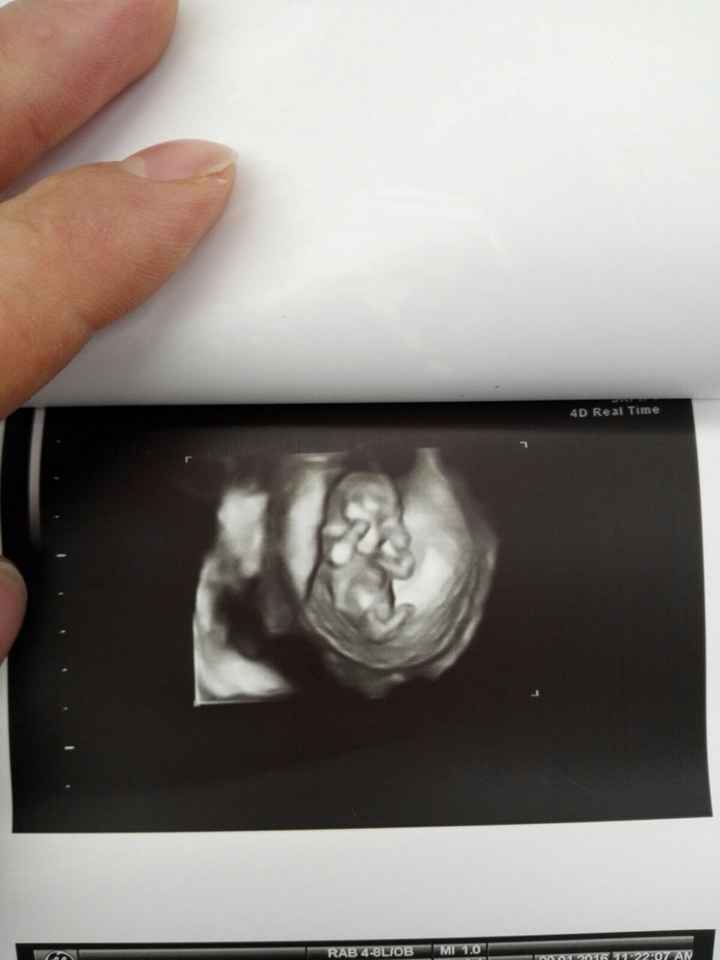 Meno male che arei fatto fatica a rimanere incinta - 1