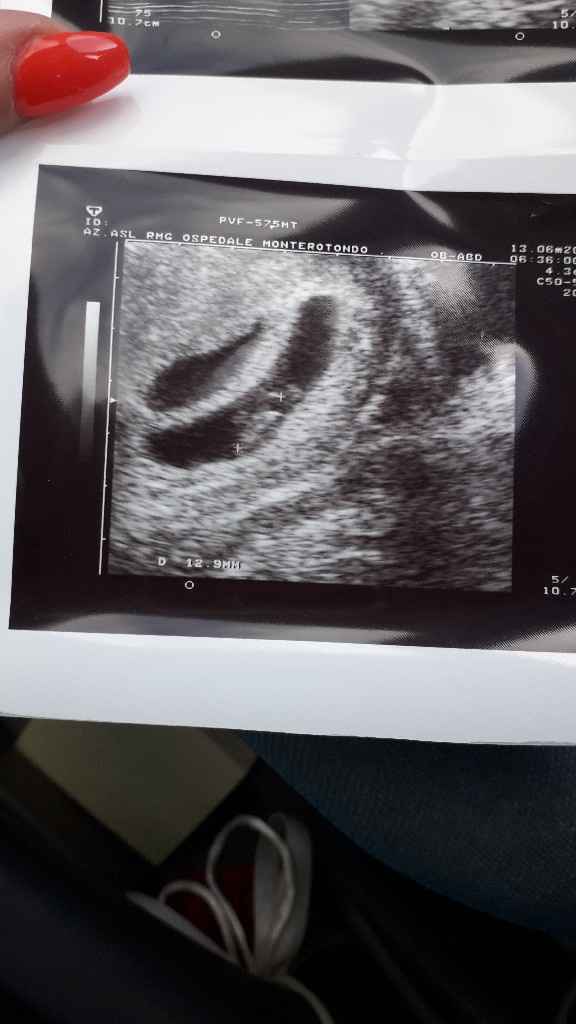 Notizia choc!!!!! - 1