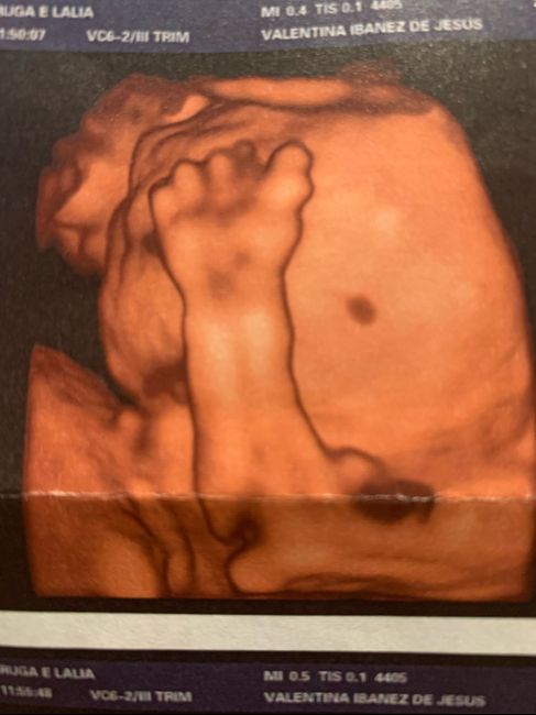Mamme di Gennaio 2020 ❤️ - 1
