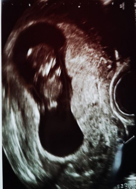 Future mamme ottobre 2020 - 1
