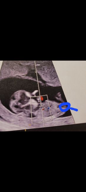 Nub theory, giochiamo un po’ - 1