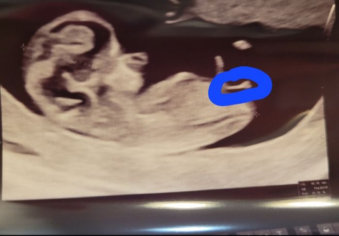 Nub theory, giochiamo un po’ 8