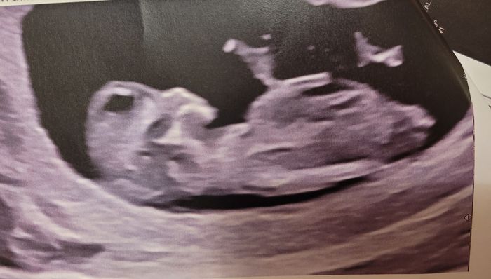 Nub theory, giochiamo un po’ 1