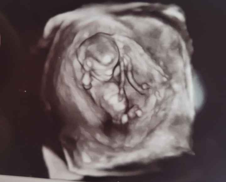 Nub theory. Maschio o femmina?💙🎀 - 1