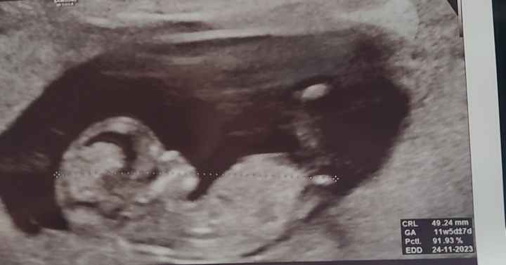 Nub theory. Maschio o femmina?💙🎀 - 2