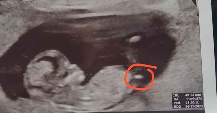 Nub theory. Maschio o femmina?💙🎀 - 1