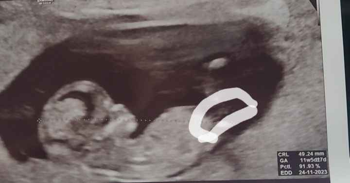 Nub theory. Maschio o femmina?💙🎀 - 1