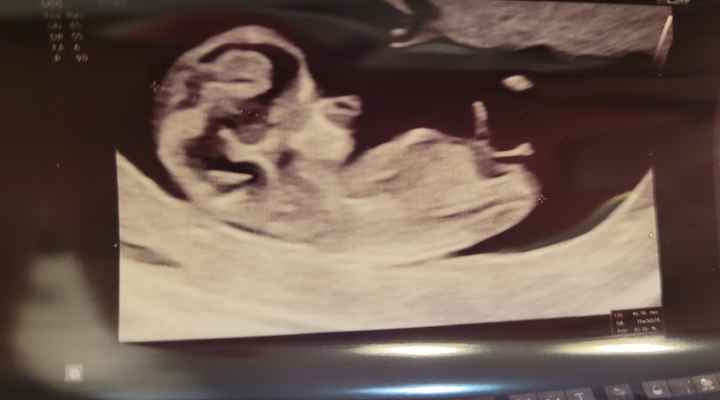 Future mamme Giugno 2025 ❤️ - 1