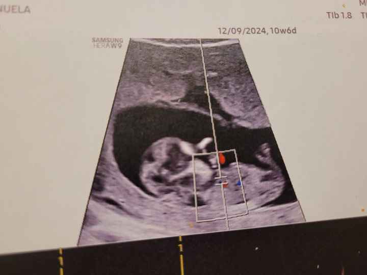 Future mamme Giugno 2025 ❤️ - 1