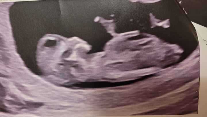 Nub theory, giochiamo un po’ - 1