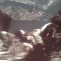 Future mamme Marzo 2021 - 1