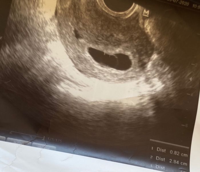 Future mamme Marzo 2021 1