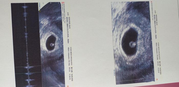 Metodo Ramzi! Chi ci sa azzeccare? - 1