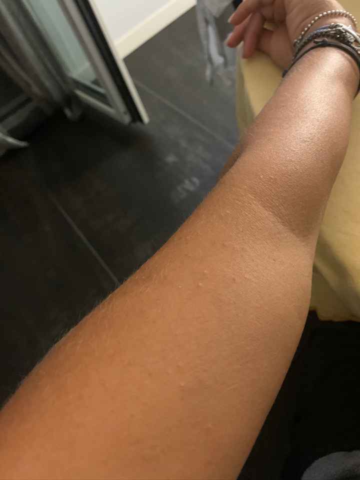 Consigli per pelle liscia e luminosa - 1