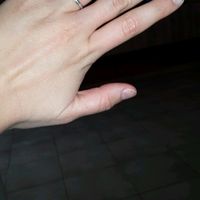 La foto del vostro anello! - 1