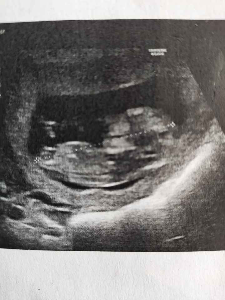 Future Mamme Settembre 2021😍 - 1