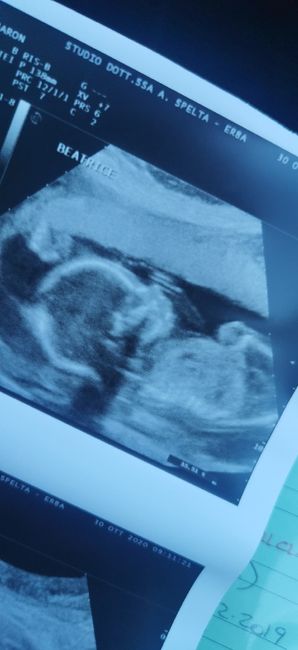 Future mamme Marzo 2021 1