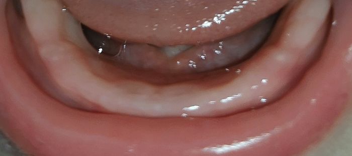 Dentini 😁 1